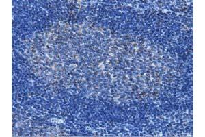 Immunohistochemical staining of paraffin-embedded Human lymph node tissue using anti-IVD mouse monoclonal antibody. (IVD anticorps)