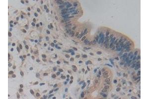 Detection of NUP85 in Mouse Uterus Tissue using Polyclonal Antibody to Nucleoporin 85 (NUP85) (NUP85 anticorps  (AA 418-653))