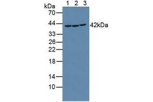Western blot analysis of (1) Mouse Placenta Tissue, (2) Rat Placenta Tissue and (3) Human K562 Cells. (RIPK2 anticorps  (AA 432-540))