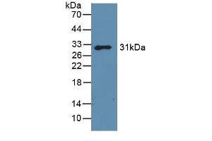 Detection of Recombinant GAL3, Mouse using Polyclonal Antibody to Galectin 3 (GAL3)