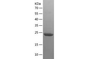 Western Blotting (WB) image for Bromodomain Containing 1 (BRD1) (AA 852-1058) protein (His tag) (ABIN7122045)