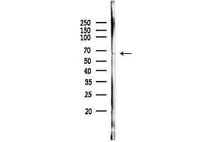anti-Zinc Finger and SCAN Domain Containing 25 (ZSCAN25) antibody