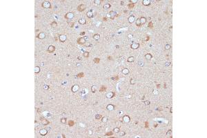 Immunohistochemistry of paraffin-embedded mouse brain using COPG2 antibody (ABIN7266425) at dilution of 1:100 (40x lens).