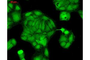 Immunocytochemistry/Immunofluorescence analysis using Rabbit Anti-Rab4 Polyclonal Antibody . (Rab4 anticorps  (C-Term) (PE))
