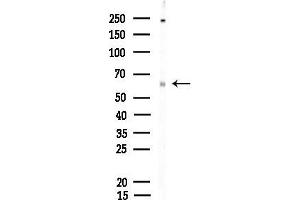 anti-P21-Activated Kinases 1/2/3 (PAK1/2/3) (pSer139), (pSer141), (pSer144) antibody