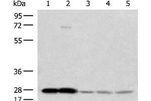 Western blot analysis of Human cerebella tissue Human cerebrum tissue Human skin tissue NIH/3T3 cell SKOV3 cell lysates using OVOL2 Polyclonal Antibody at dilution of 1:350 (OVOL2 anticorps)