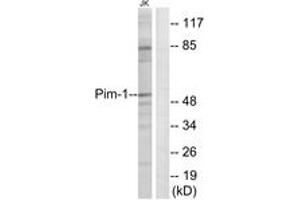 Western blot analysis of extracts from Jurkat cells, using Pim-1 (Ab-309) Antibody. (PIM1 anticorps  (AA 281-330))