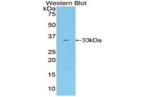 Western Blotting (WB) image for anti-Interleukin 20 Receptor alpha (IL20RA) (AA 268-538) antibody (ABIN1859400)