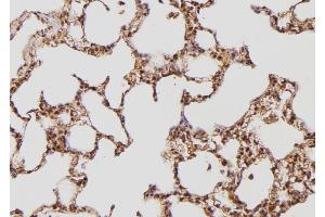 ABIN6274169 at 1/100 staining Rat lung tissue by IHC-P.