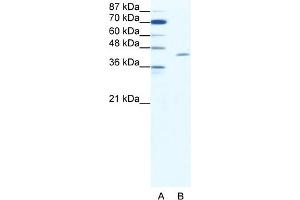 WB Suggested Anti-TAL1 Antibody Titration:  1. (TAL1 anticorps  (C-Term))