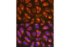 Immunofluorescence analysis of U-2 OS cells using IMPDH2 Rabbit mAb  at dilution of 1:100 (40x lens).