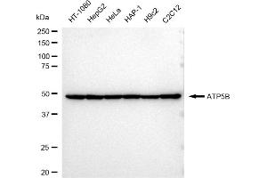Western blotting analysis using ATP5B antibody (ABIN7797681).