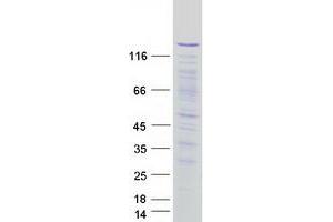 Validation with Western Blot