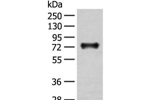 Western blot analysis of Mouse brain tissue lysate using KAT14 Polyclonal Antibody at dilution of 1:300 (KAT14 anticorps)