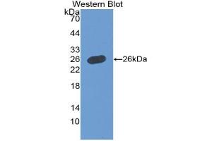 Western blot analysis of the recombinant protein. (Growth Hormone 1 anticorps  (AA 28-217))