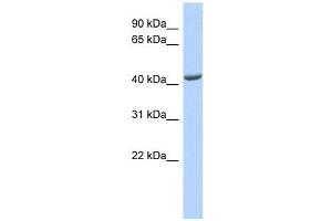 ST3GAL4 antibody used at 1 ug/ml to detect target protein. (ST3GAL4 anticorps  (Middle Region))
