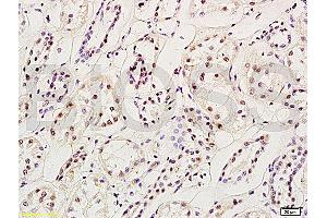 Formalin-fixed and paraffin embedded: rat brain tissue labeled with Anti-MGMT Polyclonal Antibody (ABIN730768), Unconjugated at 1:200, followed by conjugation to the secondary antibody and DAB staining (MGMT anticorps  (AA 101-207))