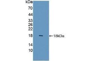 Detection of Recombinant FABP6, Human using Polyclonal Antibody to Fatty Acid Binding Protein 6, Ileal (FABP6) (FABP6 anticorps  (AA 1-128))