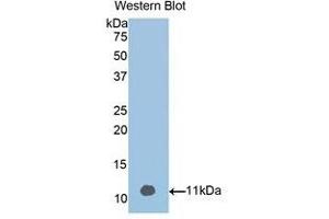 Western Blotting (WB) image for anti-Vitamin D-Binding Protein (GC) (AA 395-473) antibody (ABIN1858609) (Vitamin D-Binding Protein anticorps  (AA 395-473))