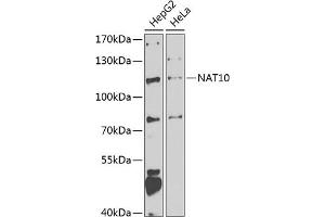 Western blot analysis of extracts of various cell lines, using N antibody (ABIN6132968, ABIN6144376, ABIN6144377 and ABIN6223123) at 1:1000 dilution.