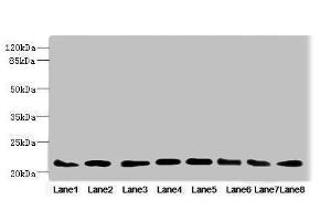 Western blot All lanes: RAB23 antibody at 3. (RAB23 anticorps  (AA 1-237))