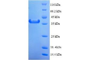SDS-PAGE (SDS) image for MAD2 Mitotic Arrest Deficient-Like 1 (Yeast) (MAD2L1) (AA 2-205) protein (His-SUMO Tag) (ABIN5711285) (MAD2L1 Protein (AA 2-205) (His-SUMO Tag))