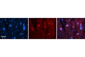 Rabbit Anti-Arih2 Antibody  Catalog Number: ARP57936_P050 Formalin Fixed Paraffin Embedded Tissue: Human Adult heart  Observed Staining: Nuclear Primary Antibody Concentration: 1:100 Secondary Antibody: Donkey anti-Rabbit-Cy2/3 Secondary Antibody Concentration: 1:200 Magnification: 20X Exposure Time: 0. (ARIH2 anticorps  (C-Term))