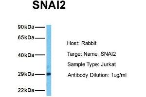 Host: Rabbit Target Name: SNAI2 Sample Tissue: Human Jurkat Antibody Dilution: 1. (SLUG anticorps  (Middle Region))