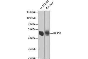 Western blot analysis of extracts of various cell lines, using HARS2 antibody. (HARS2 anticorps)