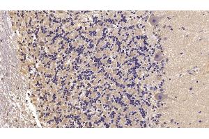 Detection of SEMA5B in Human Cerebellum Tissue using Monoclonal Antibody to Semaphorin 5B (SEMA5B) (SEMA5B anticorps  (AA 36-602))