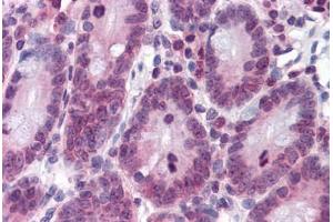 Human Small Intestine: Formalin-Fixed, Paraffin-Embedded (FFPE)