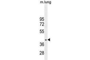 RNF215 Antibody (C-term) western blot analysis in mouse lung tissue lysates (35µg/lane).