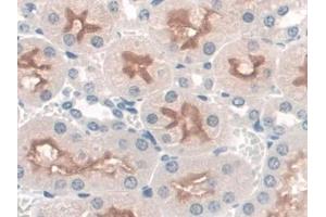 Detection of SNTb1 in Mouse Kidney Tissue using Polyclonal Antibody to Syntrophin Beta 1 (SNTb1)