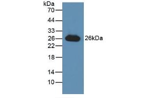 Figure. (GSTA3 anticorps  (AA 1-222))