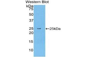 Western blot analysis of the recombinant protein. (CELA1 anticorps  (AA 44-259))