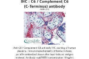 Image no. 1 for anti-Complement Component 6 (C6) antibody (ABIN1723410) (C6 anticorps)