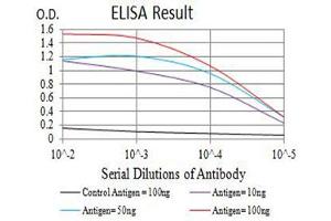 Black line: Control Antigen (100 ng),Purple line: Antigen (10 ng), Blue line: Antigen (50 ng), Red line:Antigen (100 ng)
