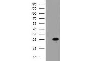 Western Blotting (WB) image for anti-Adenylate Kinase 3 (AK3) antibody (ABIN1496520) (Adenylate Kinase 3 anticorps)