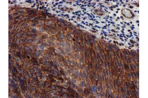 Image no. 2 for anti-Makorin Ring Finger Protein 1 (MKRN1) antibody (ABIN1499486)