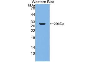 Western blot analysis of the recombinant protein. (TRAF1 anticorps  (AA 169-392))