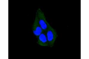 Immunofluorescence analysis of HeLa cells using ARRB1 antibody (ABIN5996907). (beta Arrestin 1 anticorps)