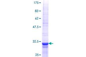 Image no. 1 for Tolloid-Like 1 (TLL1) (AA 77-150) protein (GST tag) (ABIN1322848)