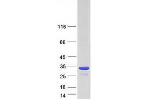 Validation with Western Blot