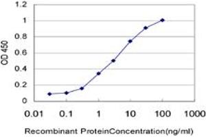 Detection limit for recombinant GST tagged SIX4 is approximately 0. (SIX4 anticorps  (AA 672-780))