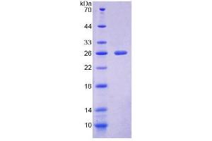 SDS-PAGE (SDS) image for Natural Cytotoxicity Triggering Receptor 1 (NCR1) (AA 17-211) protein (His tag) (ABIN4988881) (NCR1 Protein (AA 17-211) (His tag))