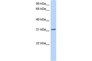 WB Suggested Anti-GSC Antibody Titration: 0.
