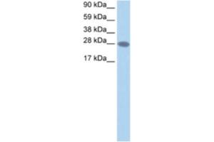 Western Blotting (WB) image for anti-Transcription Elongation Factor A2 (TCEA2) antibody (ABIN2460720)