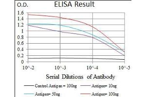 Black line: Control Antigen (100 ng), Purple line: Antigen(10 ng), Blue line: Antigen (50 ng), Red line: Antigen (100 ng), (DNAL4 anticorps  (AA 1-105))