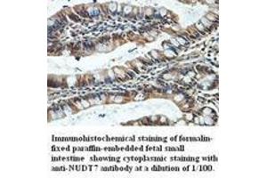 Image no. 1 for anti-Nudix (Nucleoside Diphosphate Linked Moiety X)-Type Motif 7 (NUDT7) antibody (ABIN791186)