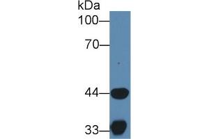 Detection of HADH in Porcine Skeletal muscle lysate using Polyclonal Antibody to Hydroxyacyl Coenzyme A Dehydrogenase (HADH) (HADH anticorps  (AA 1-236))